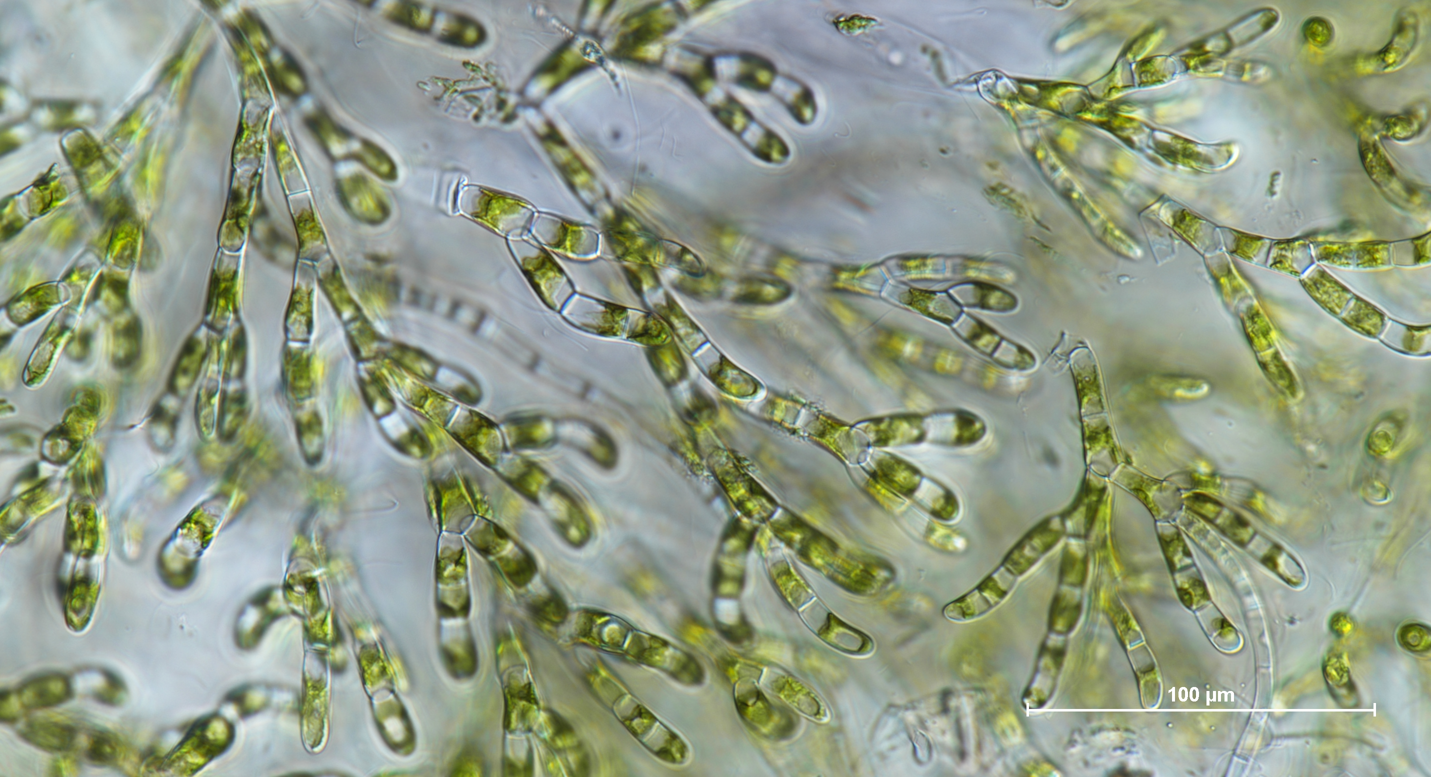 Chaetophora loba