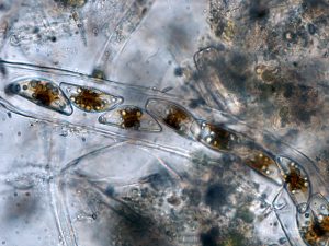 Cymbella - live material with light microscope tube dwelling diatom