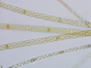 Filamentous grren algae - Spirogyra